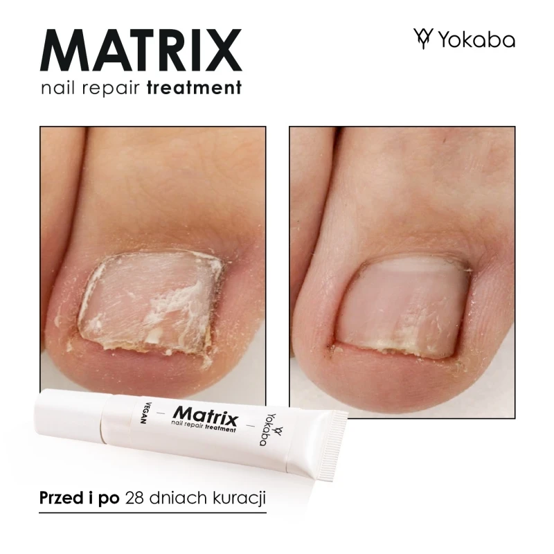 matrix-nail-repair-treatment-vegan-15ml.jpg-7.webp