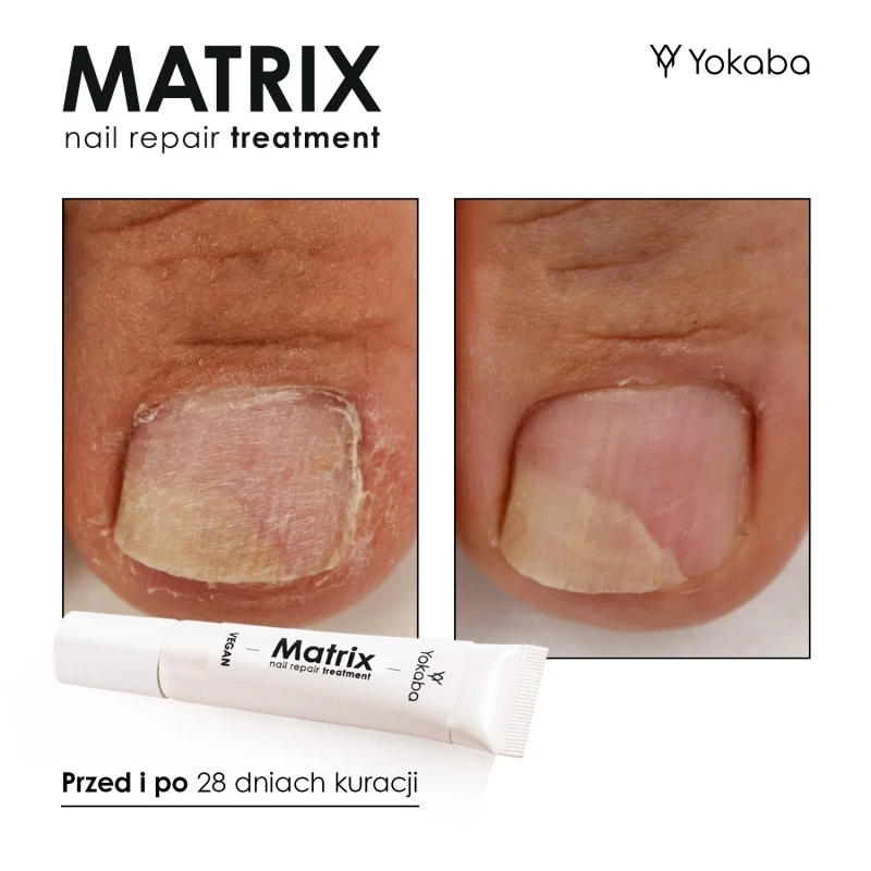 matrix-nail-repair-treatment-vegan-15ml.jpg-8.webp