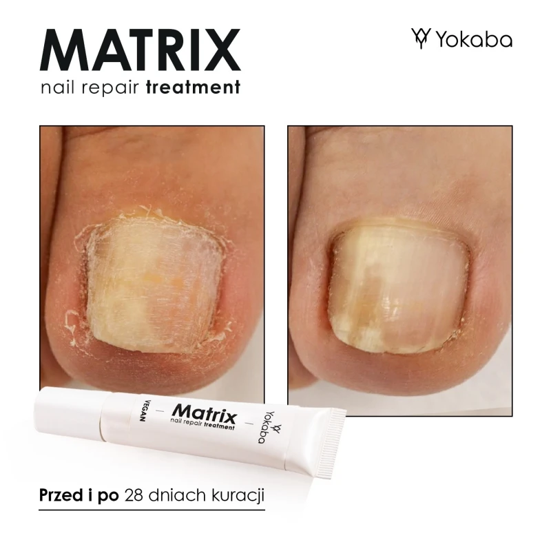 matrix-nail-repair-treatment-vegan-15ml.jpg-9.webp
