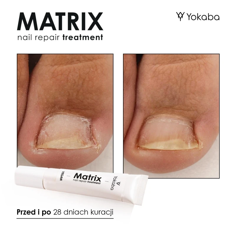 matrix-nail-repair-treatment-vegan-15ml.jpg-10.webp